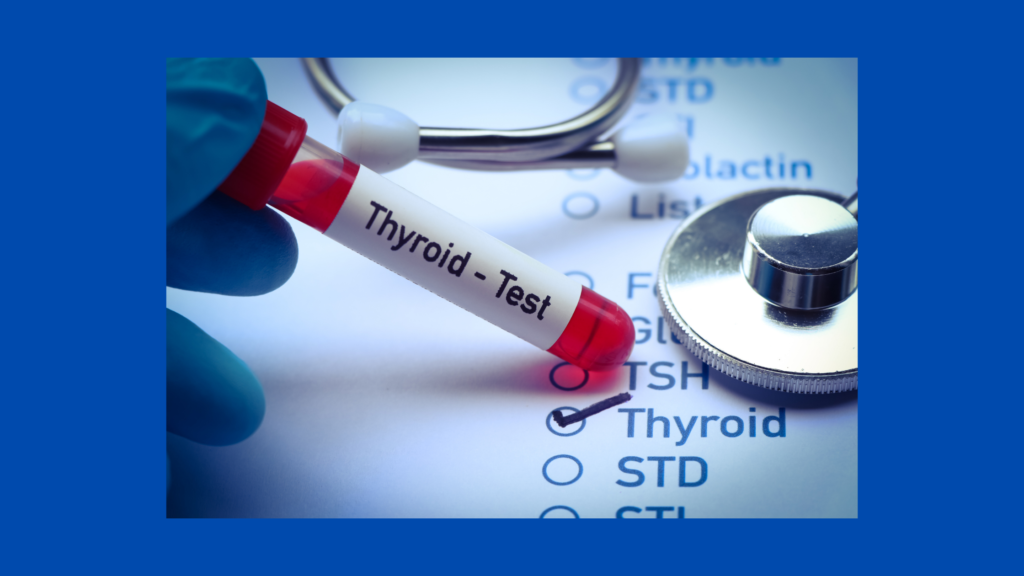 T3 T4 and Tsh normal ranges and thyroid symptom tests